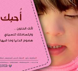 متلازمة داون
